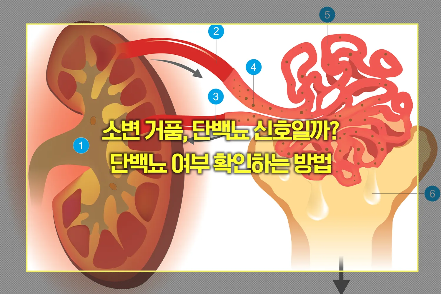 소변 거품, 단백뇨 신호일까? 단백뇨 여부 확인하는 방법 - 건강 365